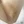 กำจัดขนรักแร้ด้วยเลเซอร์ — ก่อนทำ (120วัน) · เจฟิลคลินิก-สาขากังนัม