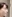 自家組織による隆鼻術（自家軟骨・真皮脂肪） — Mind Plastic Surgery