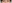 裏ハムラ法（経結膜的眼窩脂肪移動術） — プレジャー美容外科クリニック