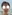Bulbous nose correction (surgical nasal tip reduction) — Coco Line Clinic