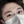 สักคิ้ว (คิ้วกึ่งถาวร) — หลังทำ · คลินิก Rianchaewoom
