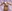 豊胸（脂肪注入） — ライアン美容外科クリニック