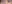 裏ハムラ法（経結膜的眼窩脂肪移動術） — プレジャー美容外科クリニック