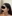 jaw angle reduction (mandibular angle osteotomy) — Uri Plastic Surgery Clinic