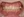 Metal bracket braces (traditional fixed orthodontics) — before (122days) · Yeonse Bareun Dental Clinic