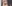 buried suture (non-incisional) double eyelid surgery — Seoul Eye Plastic Surgery Clinic