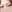 buried suture (non-incisional) double eyelid surgery — Yellow Plastic Surgery Clinic