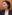 糸リフト（スレッドリフト） — ジャスト美容外科クリニック