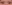 眼瞼下垂手術（目つき矯正） — プロミス美容外科クリニック