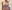 豊胸術（シリコンインプラント／人工乳腺） — バナナ美容外科クリニック
