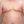 ผ่าตัดลดขนาดหน้าอก — หลังทำ (28วัน) · The Plastic Surgery Clinic
