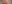 お腹の脂肪溶解注射 — ロリポップ美容外科クリニック