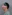 雙下巴抽脂 — Saekim 整形外科診所