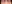 裏ハムラ法（経結膜的眼窩脂肪移動術） — ファクト美容外科クリニック