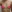 豊胸術（シリコンインプラント／人工乳腺） — ヒューマン美容外科