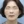 Ultracol (PDO microsphere collagen stimulator injection) — after · J.Fill Clinic - Gangnam Branch