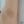 กำจัดขนรักแร้ด้วยเลเซอร์ — ก่อนทำ (120วัน) · เจฟิลคลินิก-สาขากังนัม
