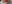 Lip filler (lip augmentation with HA) — Olliting Plastic Surgery Clinic