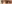 二重まぶた（自然癒着法） — デビビ美容外科クリニック