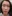 Potenza RF microneedling — TheiA Clinic - Gangnam Main Branch