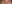 眉毛挙上術（ブロウリフト） — エイペックス美容外科クリニック