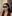 Platysma plication (corset platysmaplasty for double chin/jawline) — Dasipium Plastic Surgery Clinic