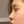Nasal osteotomy (nasal bone narrowing) — after (7days) · Code Plastic Surgery Clinic