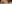 目尻切開 — アーバン美容外科クリニック