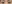 二重まぶた（自然癒着法） — アイフィット美容外科クリニック