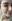 Forehead wrinkle Botox (frontalis lines) — Beauty Blossom Clinic
