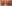 lower blepharoplasty (under-eye bag removal with fat repositioning) — Pleasure Plastic Surgery Clinic
