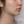 Density Lifting (RF skin tightening / lifting) — before · Ripain Clinic