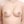 Hybrid breast augmentation (implant + fat grafting) — after (28days) · The Plastic Surgery Clinic