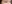 二重まぶた（自然癒着法） — ルホ美容外科クリニック