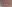Lip filler (lip augmentation with HA) — Private Beauty Clinic Jiyu