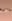 下眼瞼下至術（開下眼角） — ToBe醫美診所