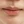 Chin botox (mentalis muscle botulinum toxin) — before · Dr. Sem Magic Beauty Clinic