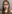 額縮小術（生え際下げ・ヘアライン下降術） — DM美容外科クリニック