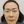 Thread lift — after · Beauty Blossom Clinic