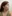 Platysma plication (corset platysmaplasty for double chin/jawline) — Myong Plastic Surgery & Aesthetics