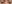 二重まぶた（自然癒着法） — プロミス美容外科クリニック