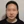 Belotero Revive (HA + glycerol skinbooster) — after (10days) · Ripain Clinic