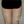Full-body liposuction — before (21days) · Aurora Clinic