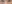 裏ハムラ法（経結膜的眼窩脂肪移動術） — リンク美容外科クリニック