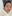 Juvelook (PDLLA + HA collagen-stimulating skin booster) — Ruby Clinic