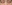 裏ハムラ法（経結膜的眼窩脂肪移動術） — ファクト美容外科クリニック