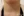 Neck wrinkle Botox (platysma band Botox / Nefertiti lift) — after (22days) · Yeonse Chungarin Clinic