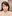 裏ハムラ法（経結膜的眼窩脂肪移動術） — ジャスト美容外科クリニック