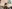 Double chin liposuction (submental liposuction) — Uri Plastic Surgery Clinic