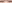 二重修正（目元の修正手術） — Unique Plastic Surgery Clinic